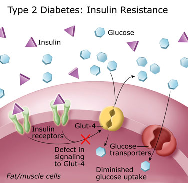 insulin2