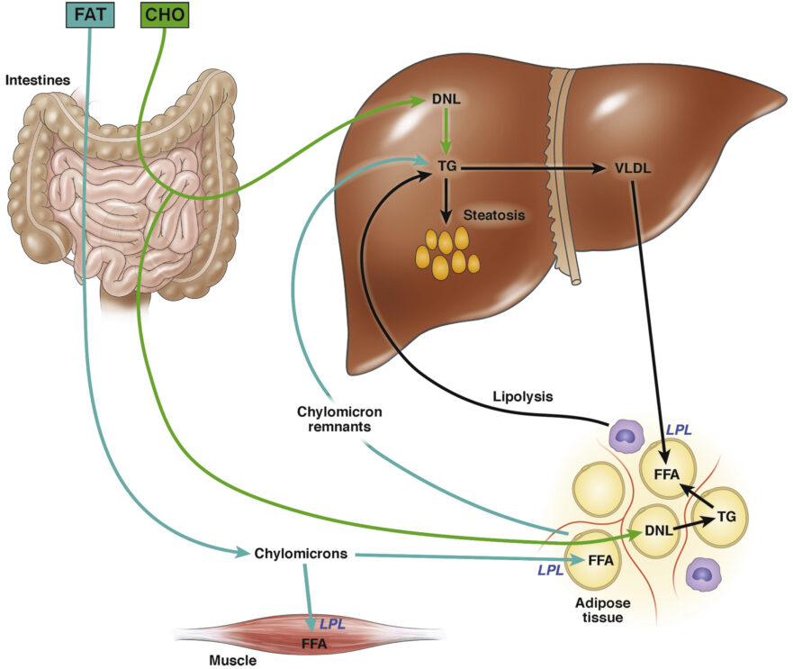 Fatty Liver: The Relationship Between Diet & NAFLD – Sigma Nutrition